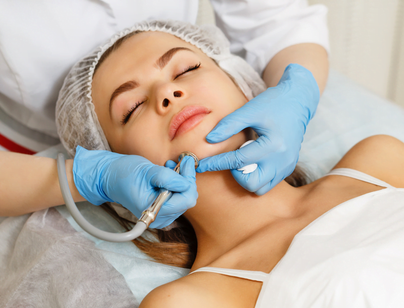Laser Treatment for Acne Scars