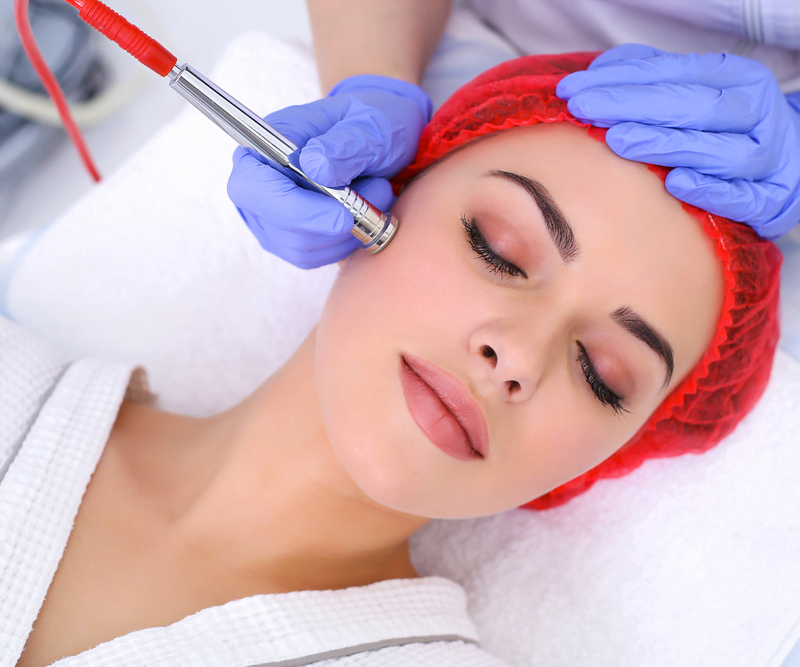 acne scar treatment