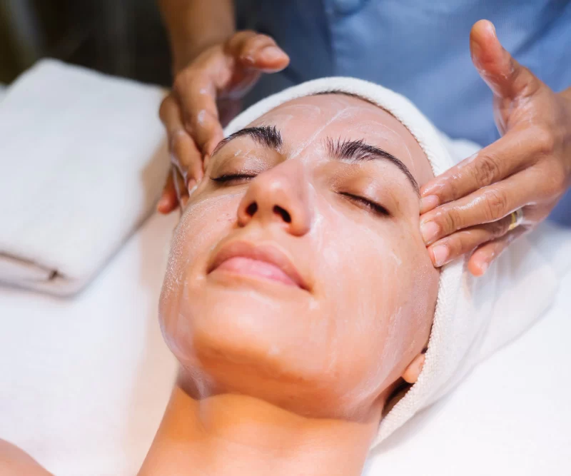Chemical Peels for Acne Scars