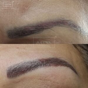 Before and after of eyebrow