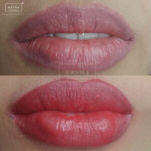 Before and after lip blush
