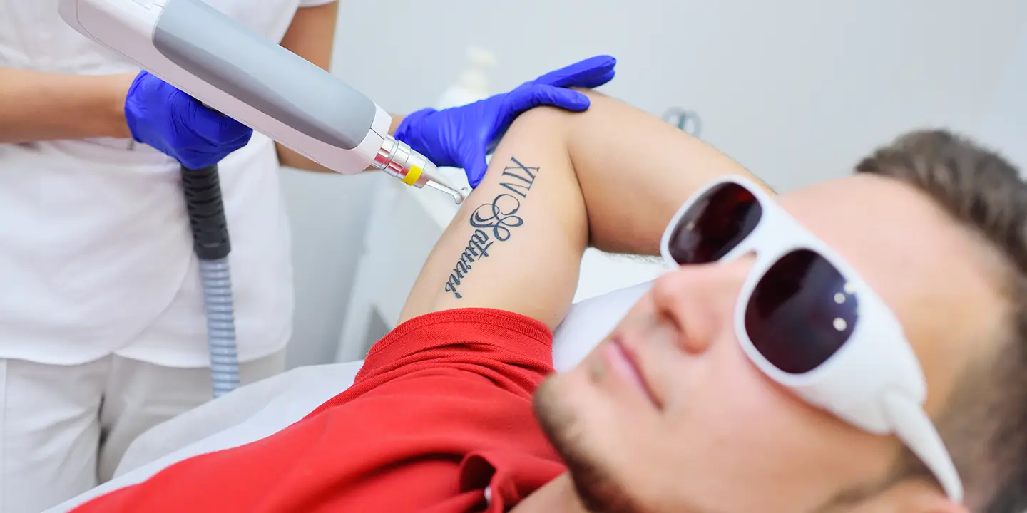 Laser Tattoo Removal: A Clinical Update