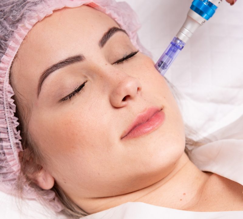 Dermapen Microneedling Treatment