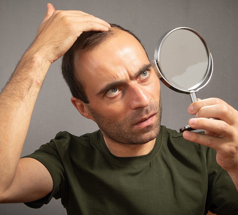Non-Surgical Hair Replacement in Delhi