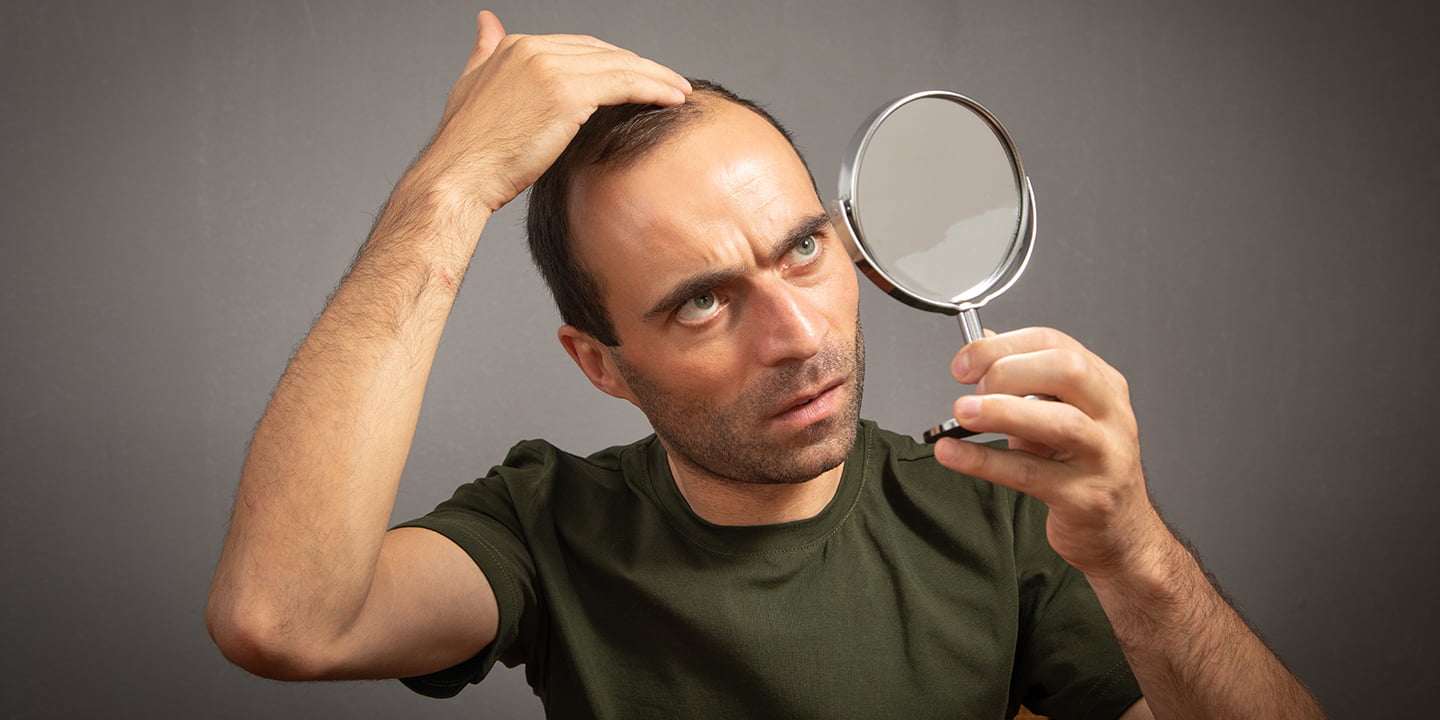 4 Non-Surgical Hair Replacement in Delhi: Which Treatment Actually Works?