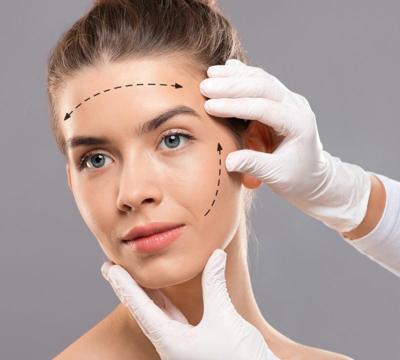 Non-Surgical Facelift
