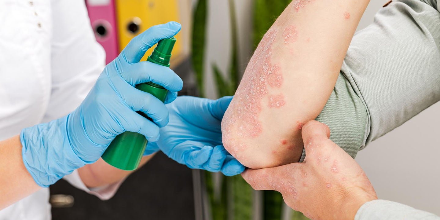 Addressing Fungal Infections with Medical Pedicures: Tips and Solutions