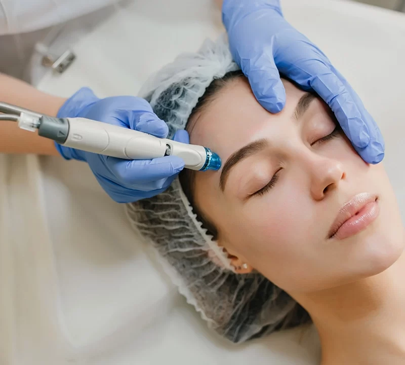 Is Hydra facial the best way for Acne Scars Treatment - AAYNA Clinic