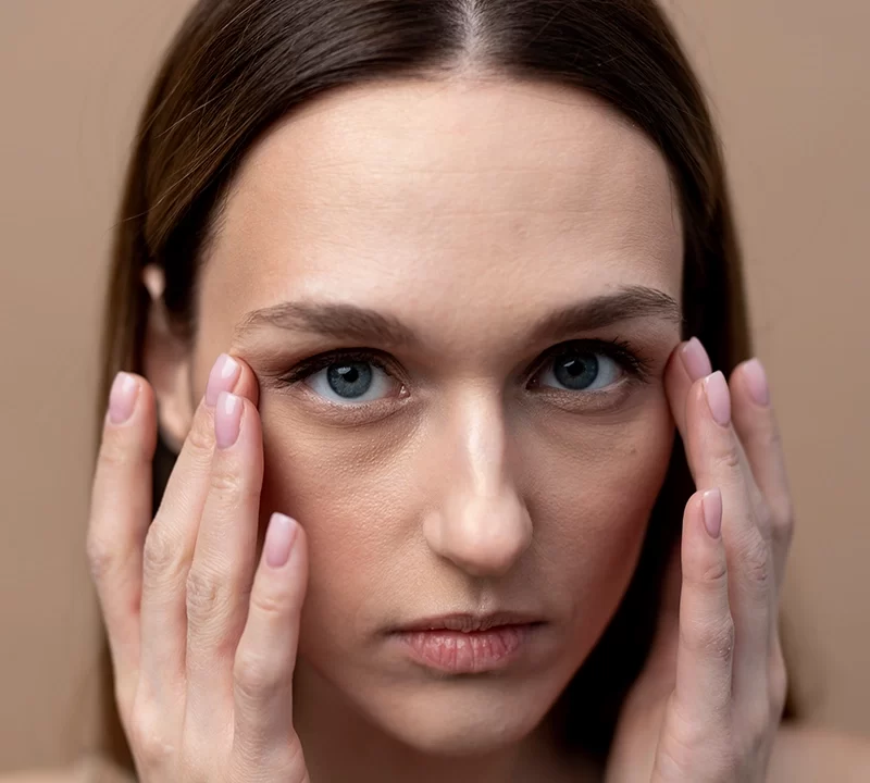 Under Eye Dark Circles Treatment