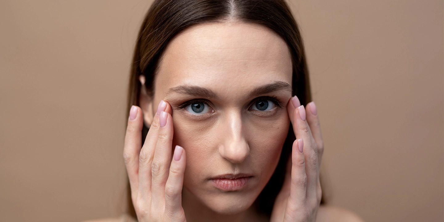 Dark Circles Under Eyes: Symptoms, Causes, and Treatment
