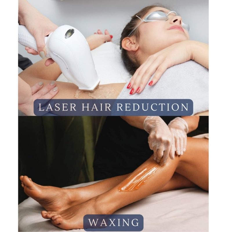 Laser Hair Removal vs Waxing