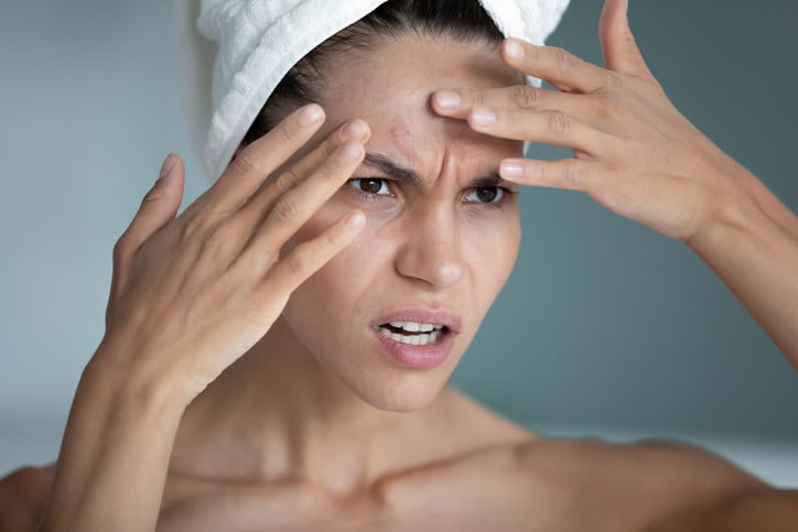 skin, stress, skin stressed