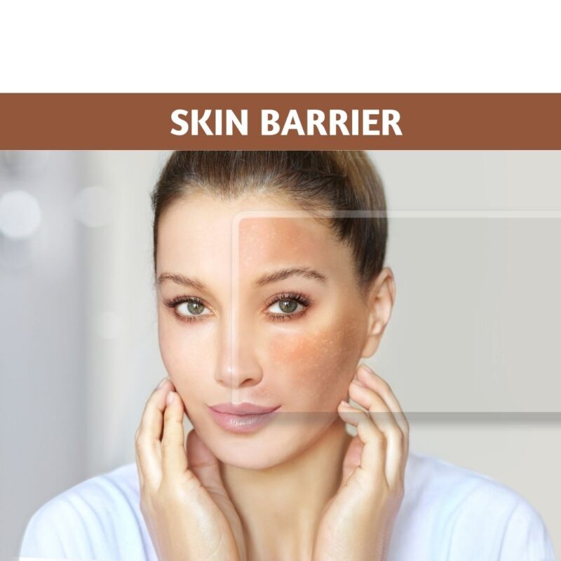 Skin Barrier
