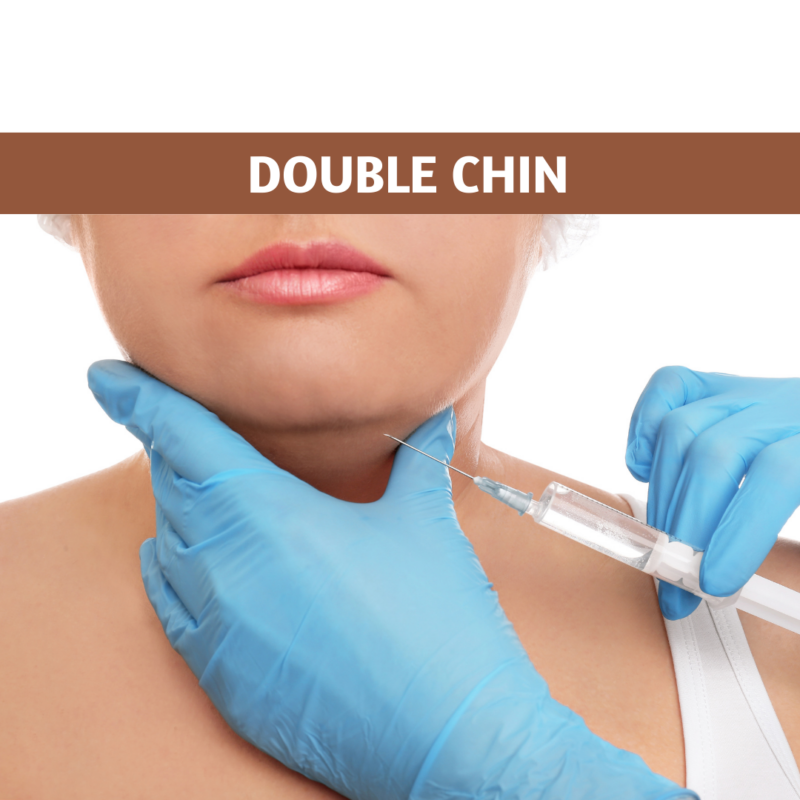 Double Chin: Fat-Dissolving Treatments