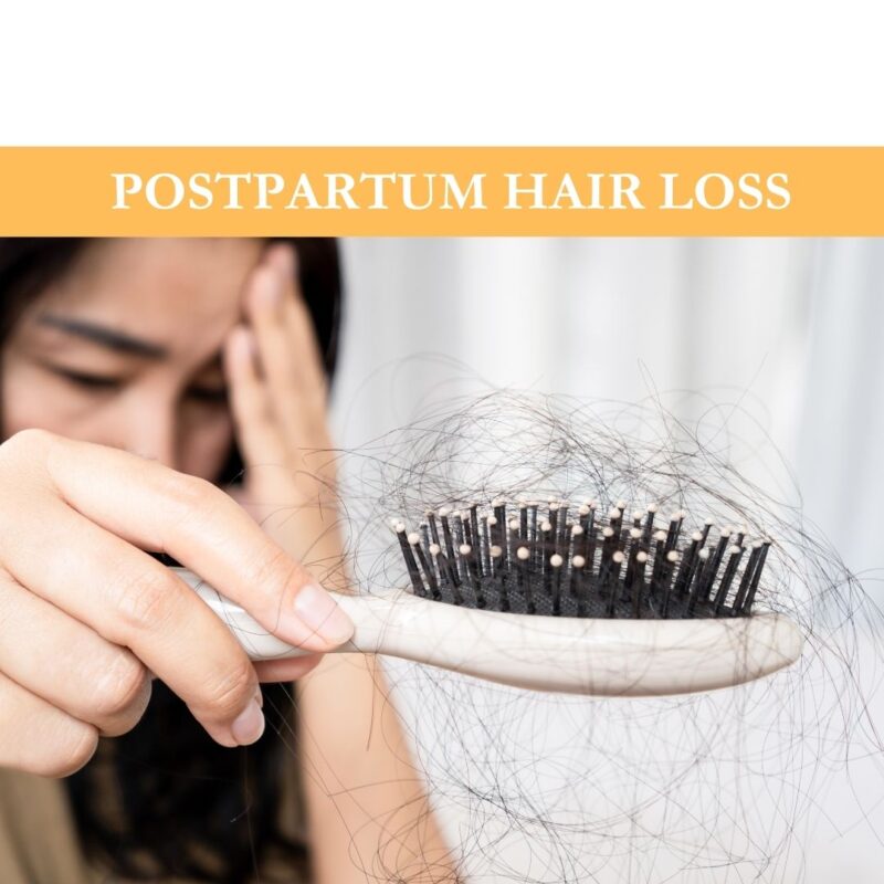 Postpartum Hair Loss