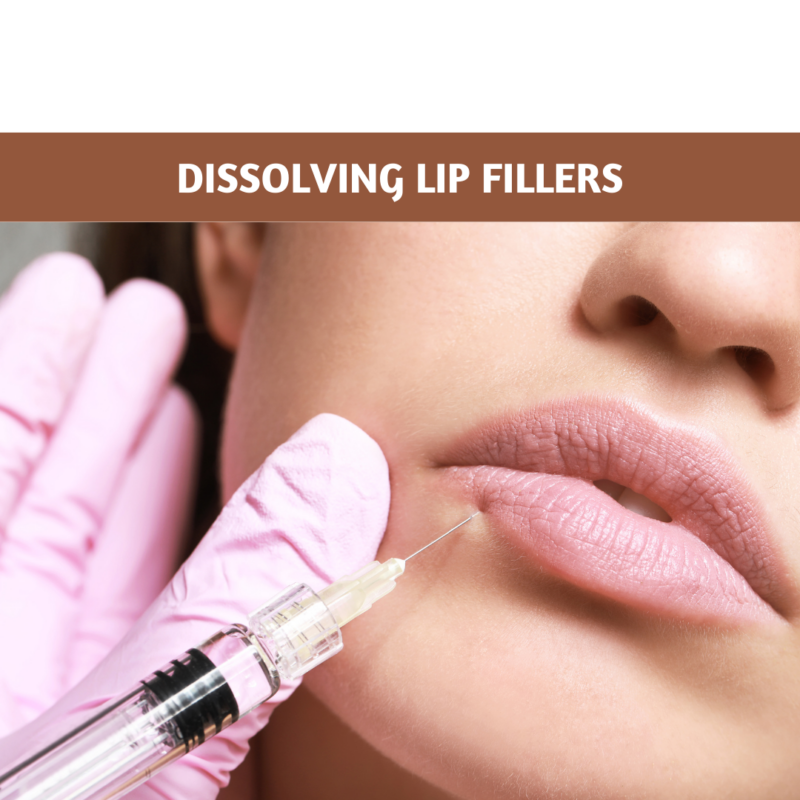 Dissolving Lip Fillers