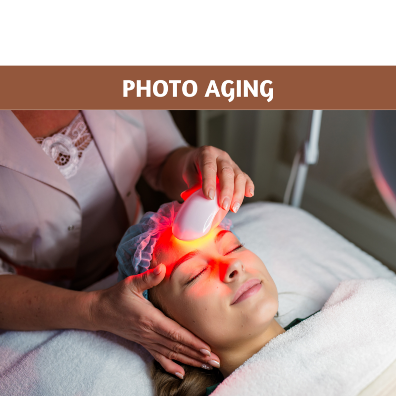 Photo Aging