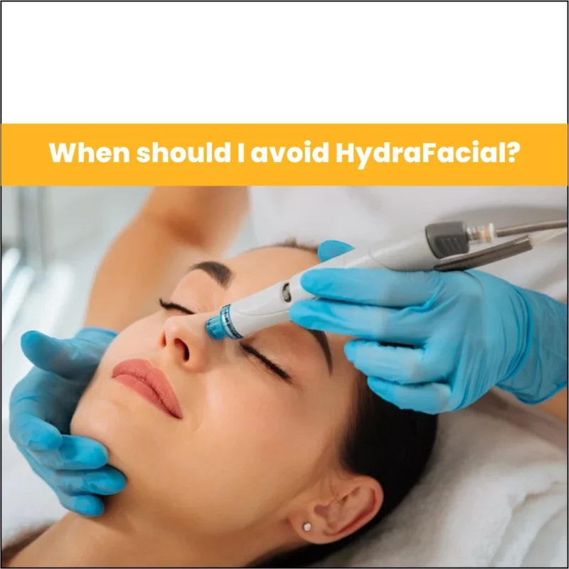 When Should I Avoid HydraFacial?