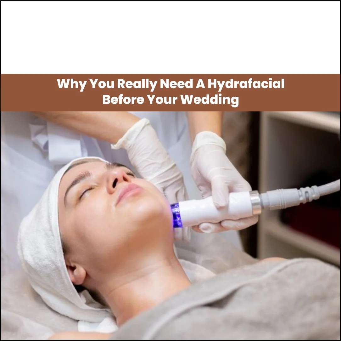 Do You Really Need a HydraFacial Before Your Wedding?