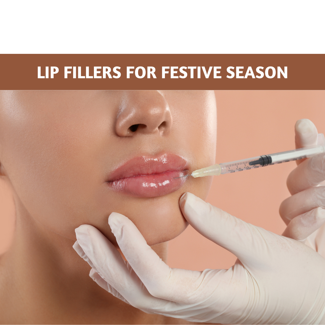 Enhance Your Smile: Lip Fillers for the Festive and Wedding Season