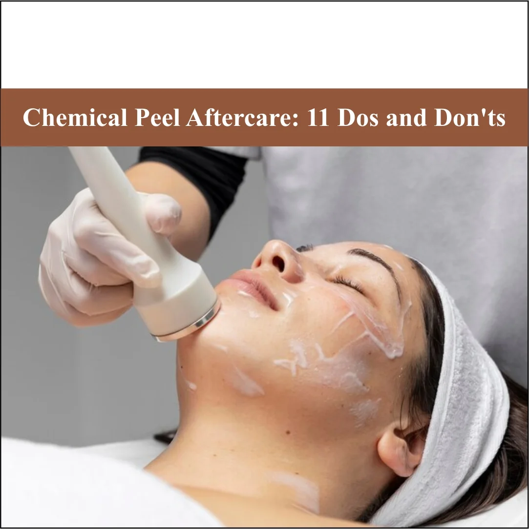Chemical Peel Aftercare: 11 Dos and Don’ts