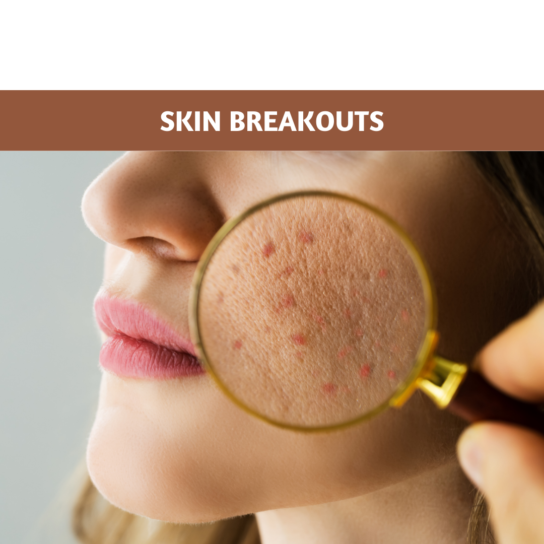 Skin Breakouts: Top Causes, Prevention, and Treatments