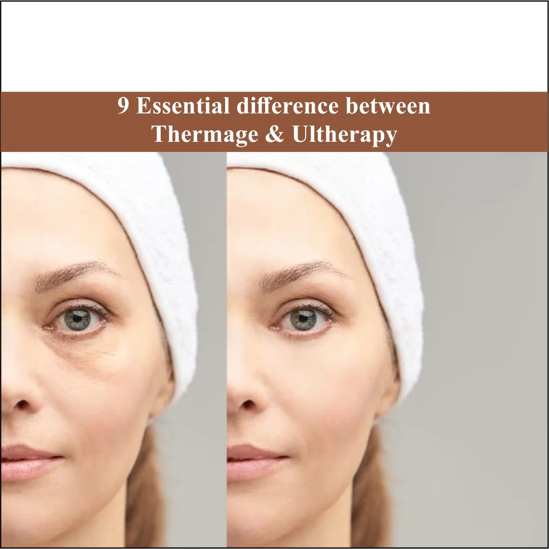 9 Essential Differences Between Thermage and Ultherapy
