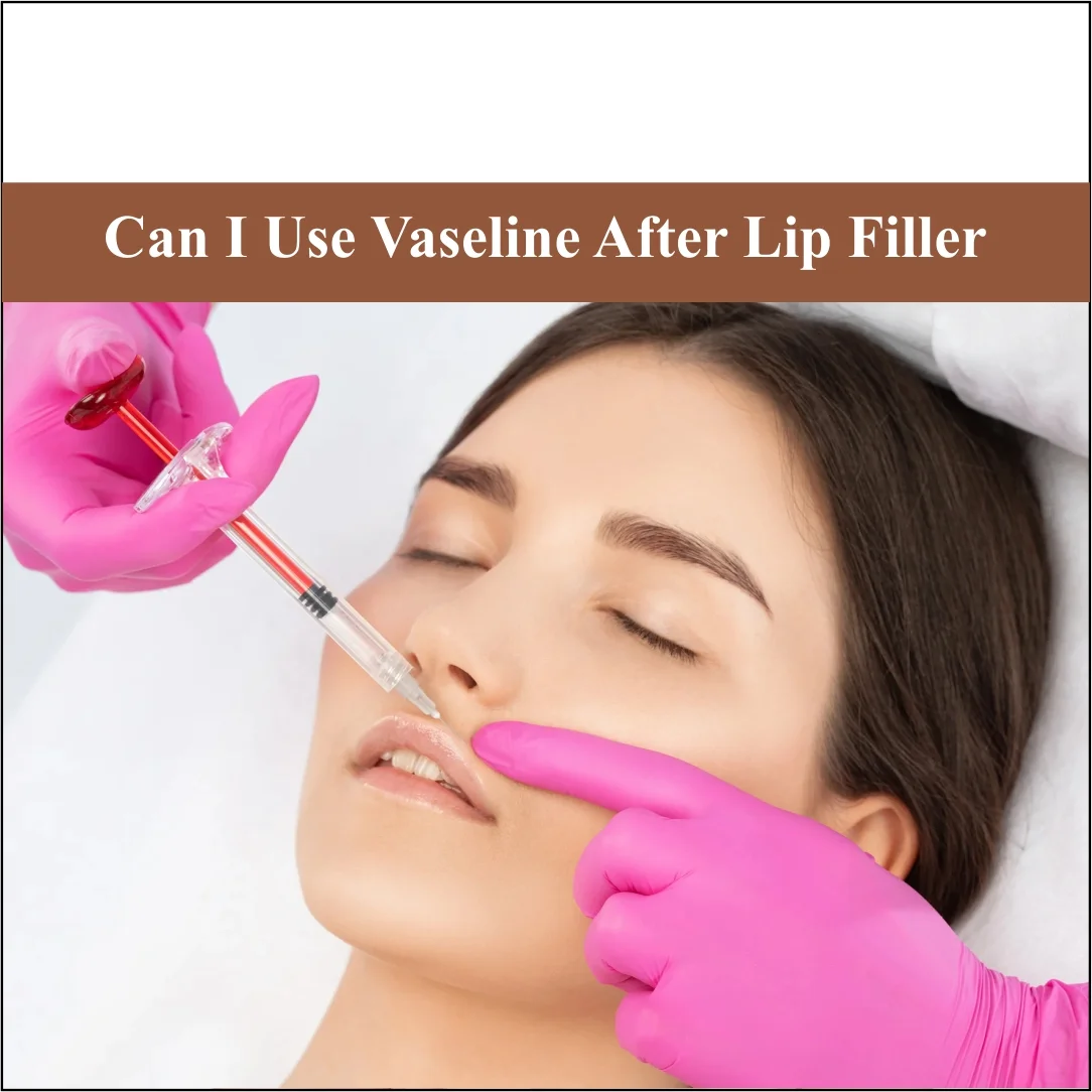 Can I Use Vaseline After Lip Filler?
