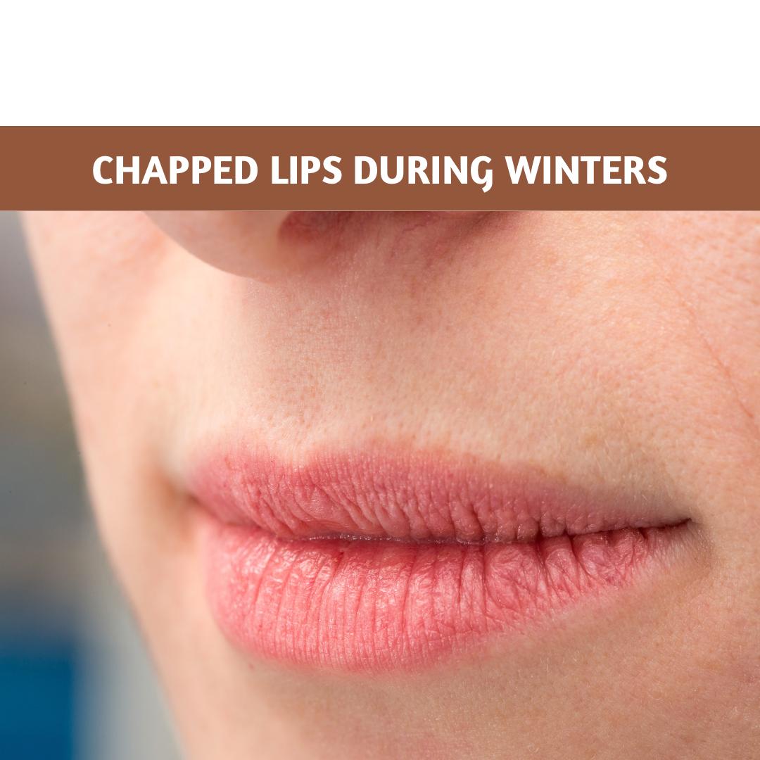 Chapped Lips: A Comprehensive Guide to Protecting Your Pout