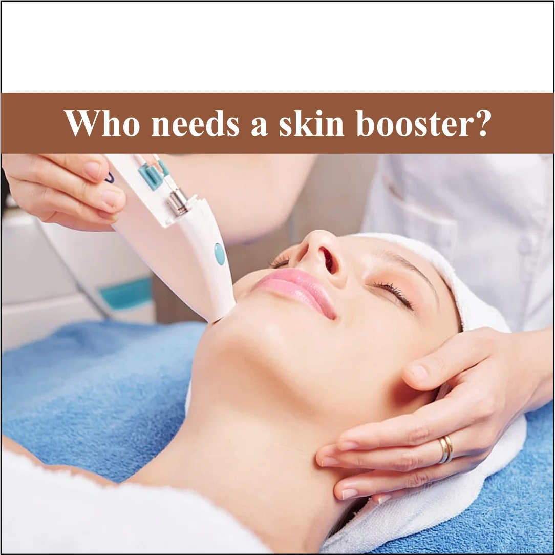 Who Needs a Skin Booster?