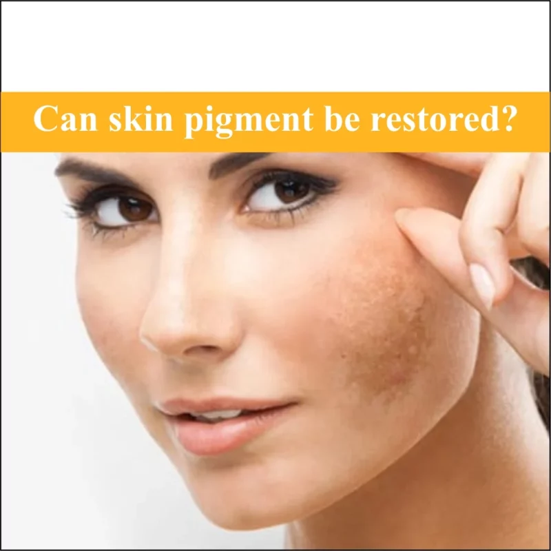 Can Skin Pigment Be Restored