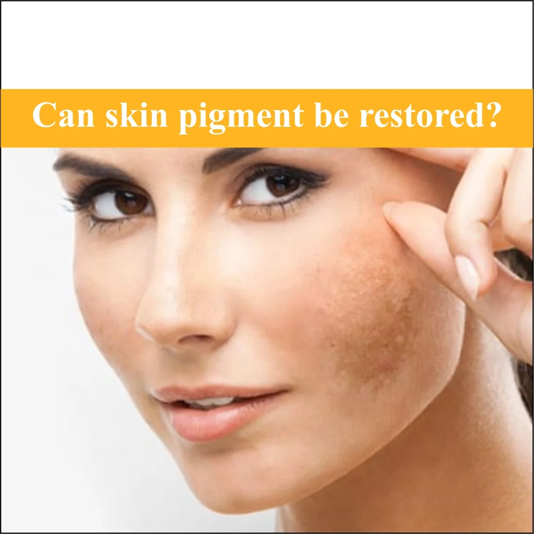 Can Skin Pigment Be Restored?