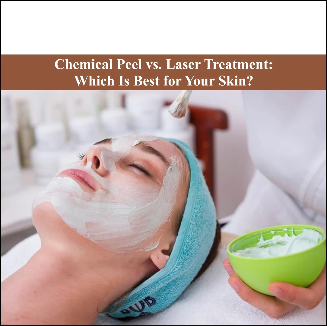 Chemical Peel vs. Laser Treatment: Which Is Best for Your Skin?