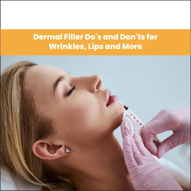 Dermal Filler Do's and Don'ts for Wrinkles