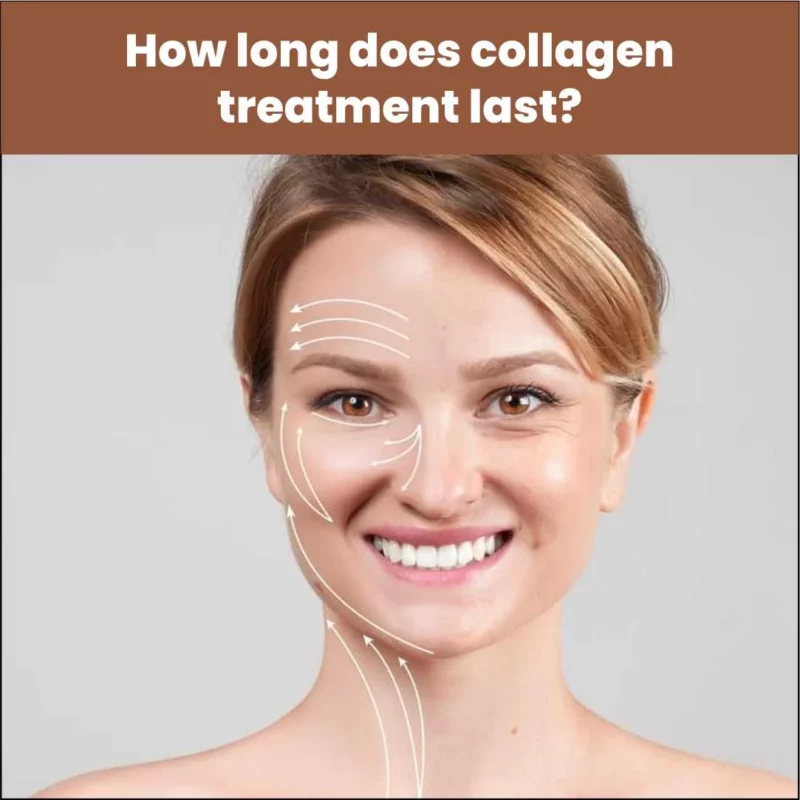 How Long Does Collagen Treatment Last?