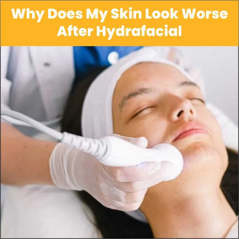 Why Does My Skin Look Worse After a HydraFacial?