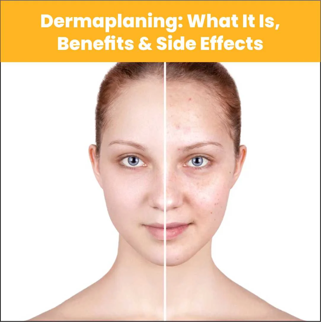 Dermaplaning: What It Is, Benefits & Side Effects