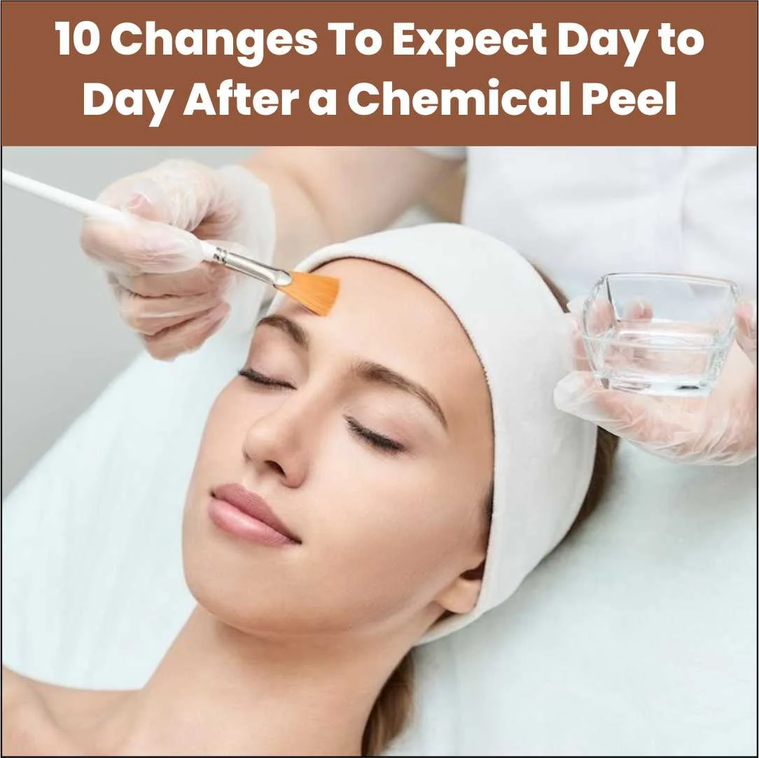 10 Changes To Expect Day to Day After a Chemical Peel