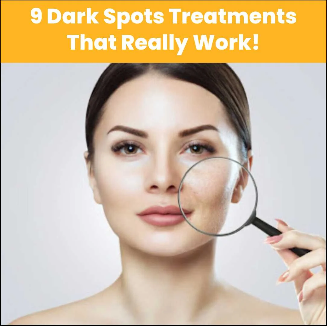 9 Dark Spots Treatments That Really Work!