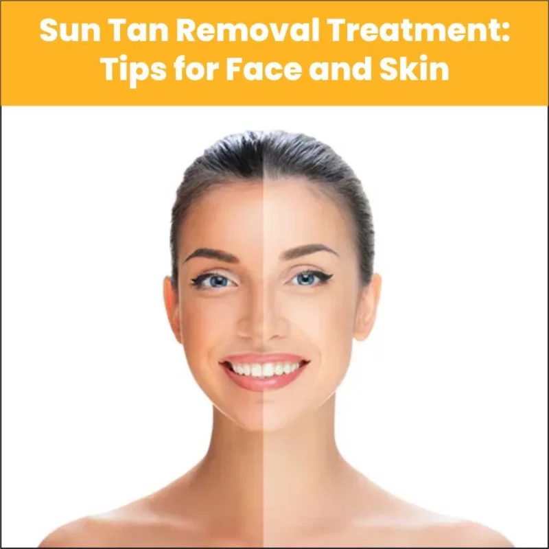 Sun Tan Removal Treatment