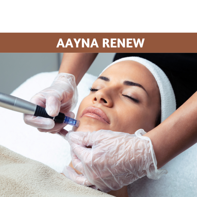 AAYNA Renew