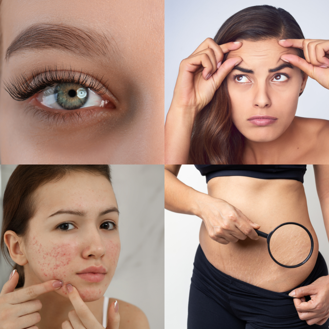 Skin concerns