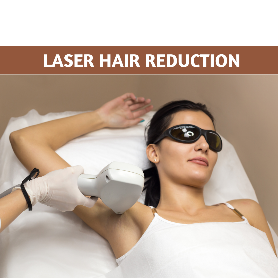 Laser Hair Reduction: Your Ultimate Hot Girl Summer Weapon