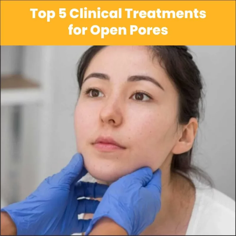 Top 5 Clinical Treatments for Open Pores