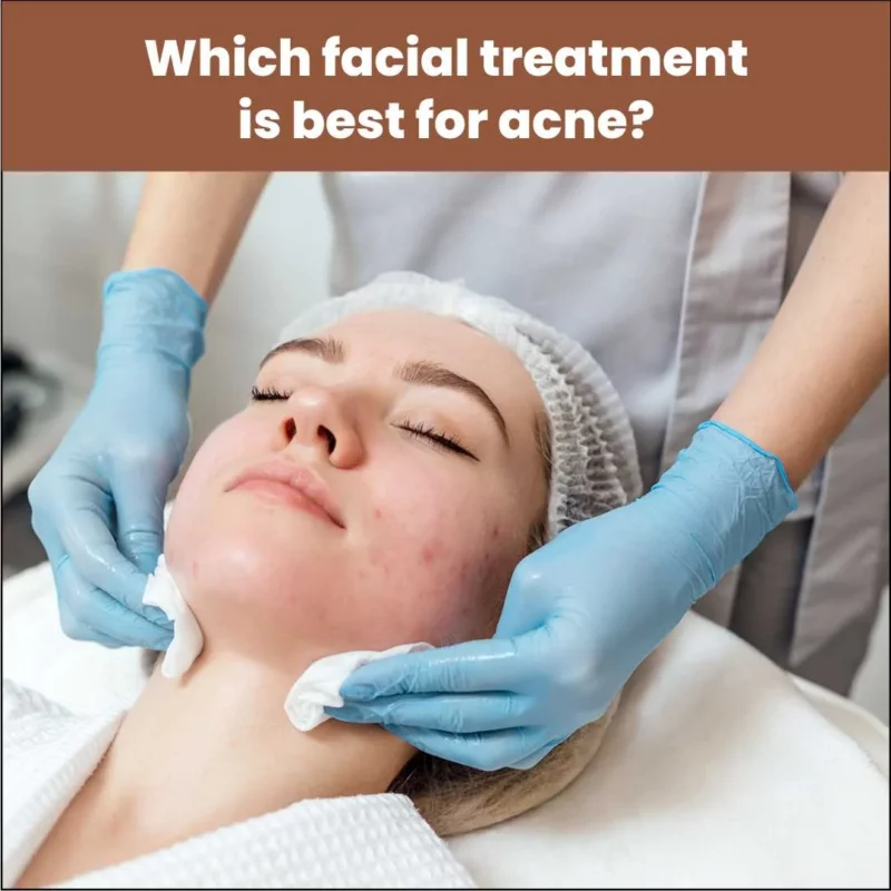 Looking for the best facial treatment for acne? AAYNA Clinic offers advanced facials, peels, and laser solutions to treat acne and rejuvenate your skin.