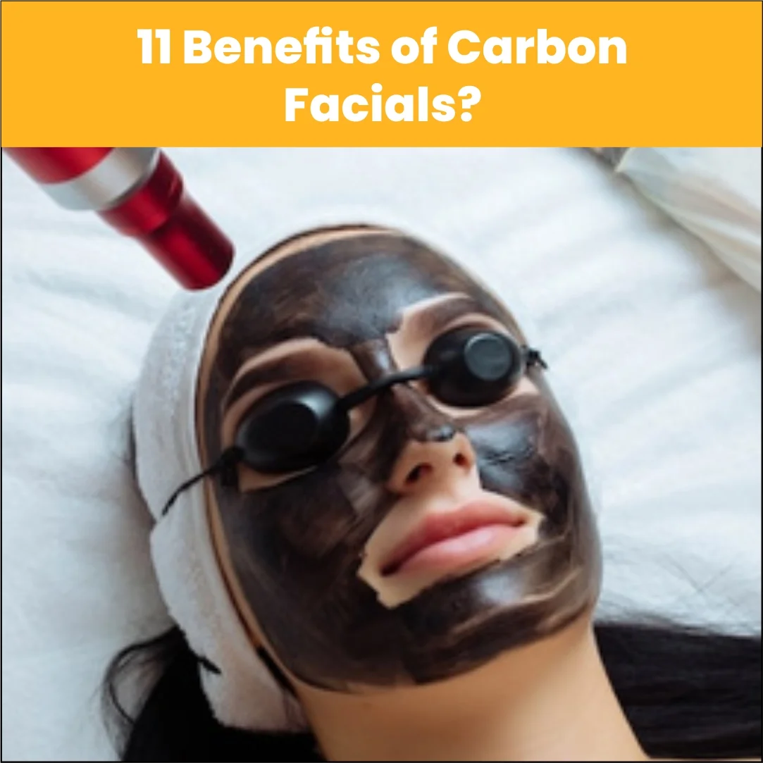 11 Benefits of Carbon Facials: Why This Treatment Is Gaining So Much Attention?