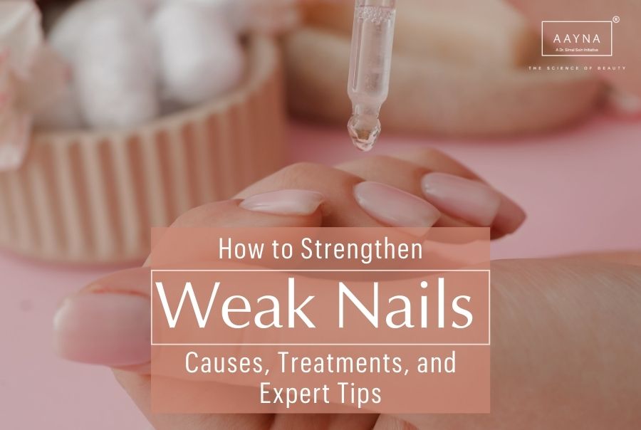 How to Strengthen Weak Nails: Causes, Treatments, and Expert Tips